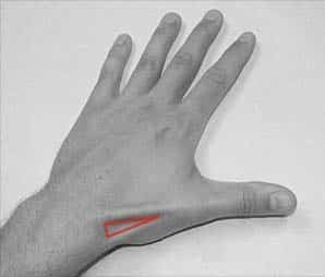 Fig 1.0 - The left anatomical snuffbox. Note its lateral position on the dorsum of the hand
