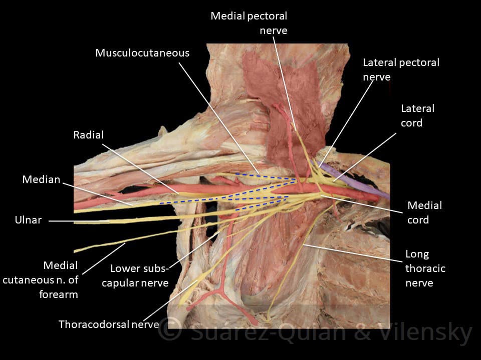 The Brachial Plexus - Sections - Branches - TeachMeAnatomy