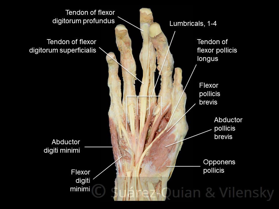 The Muscles of the Hand - Thenar - Hypothenar - TeachMeAnatomy