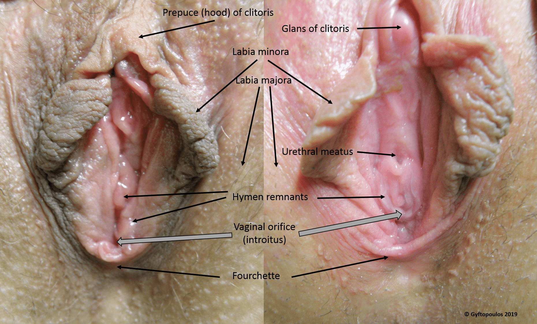 Structures of the Vulva 