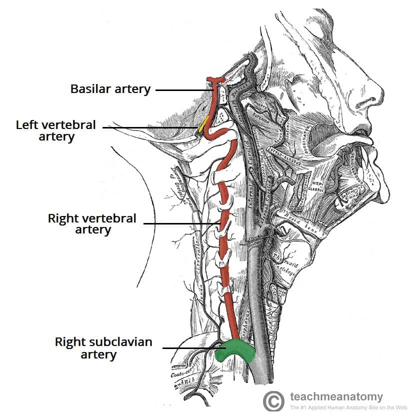 Fig 1.3 - The right vertebral artery. Note its course through the transverse foramina of the cervical vertebrae.