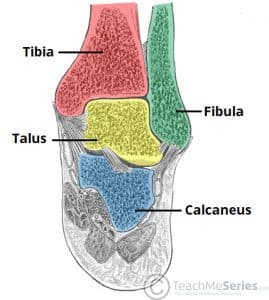 Anatomical illustration of the tibia, fibula, and talus bones of the ankle joint, indicating the calcaneus is not included.