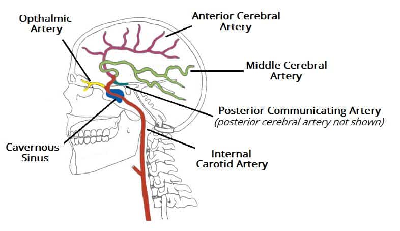 internal carotid artery skull