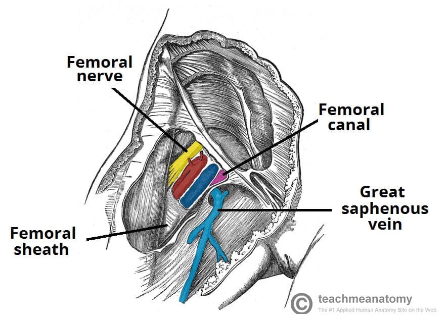 FEMORAL HERNIA – CSF Surgery