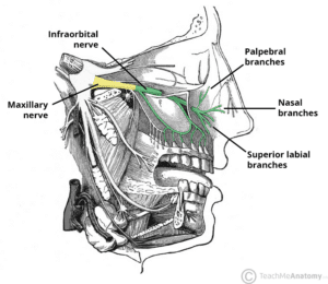Diagram illustrating the course and branches of the infraorbital nerve, including the inferior palpebral and superior labial nerves.