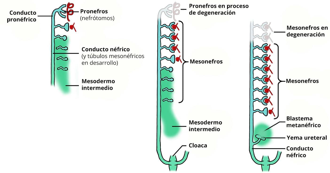 Ilustración del desarrollo renal en la que se muestran el pronefros, el mesonefros, la yema ureteral y el blastema metanéfrico.