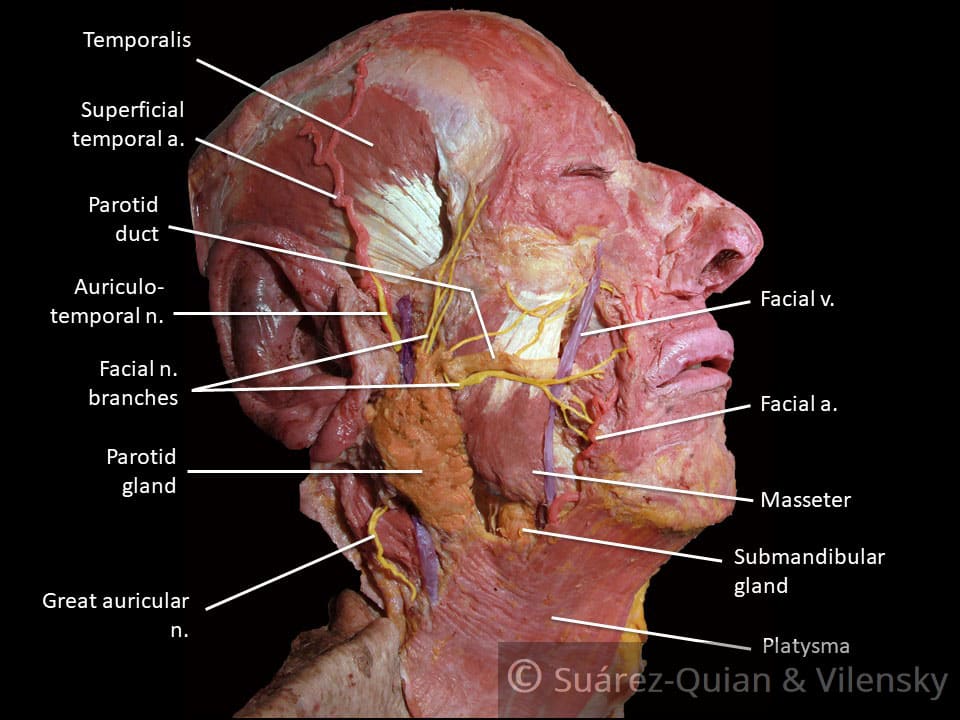 5th of facial nerve mri