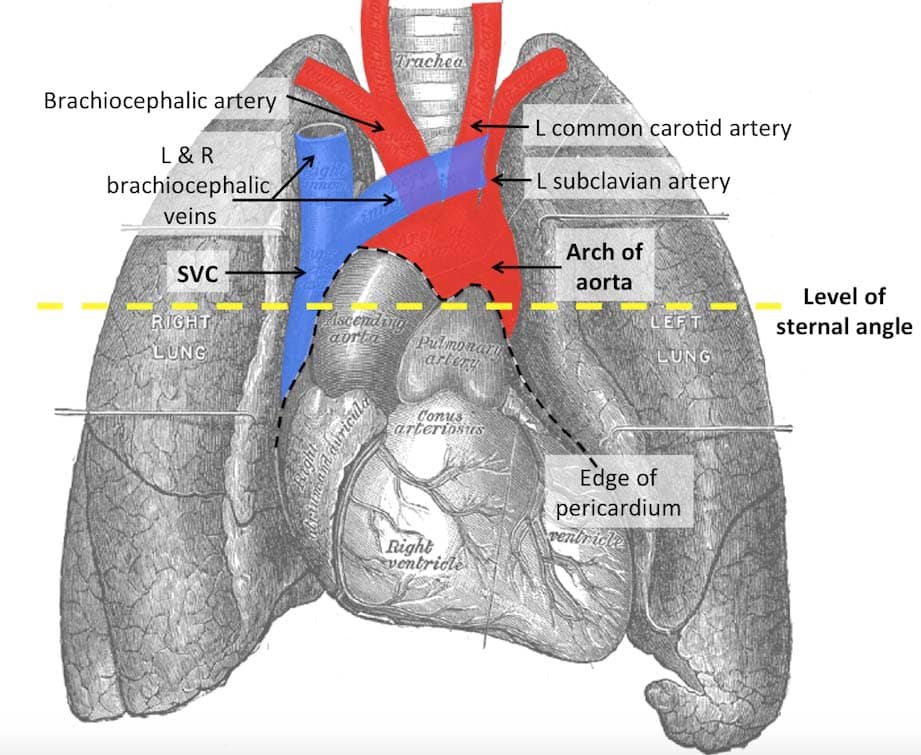Fig 2 - Great vessels within the superior mediastinum.