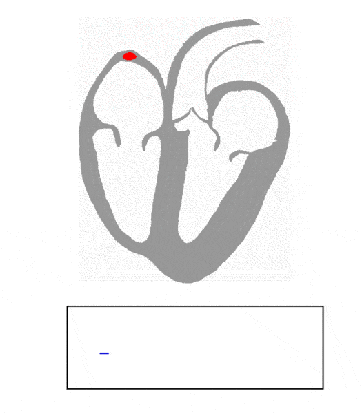 Fig 1.0 - Animation of the spread of conduction through the heart
