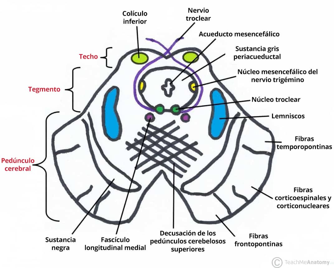 Diagrama transversal del mesencéfalo a la altura de los colículos inferiores, en el que se destacan las fibras corticonucleares (corticobulbares).