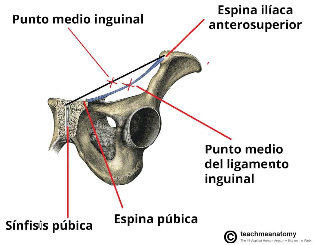 Plano coronal de la pelvis en la que se destacan el punto medio inguinal y el punto medio del ligamento inguinal.