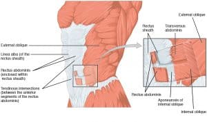 Illustration of the muscles of the anterolateral abdominal wall, highlighting the aponeuroses formed by the flat muscles.