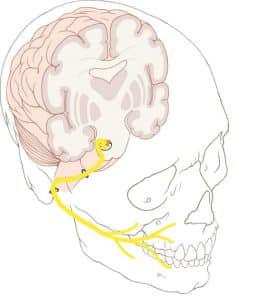 Overview of the anatomical course of the facial nerve (CN VII).