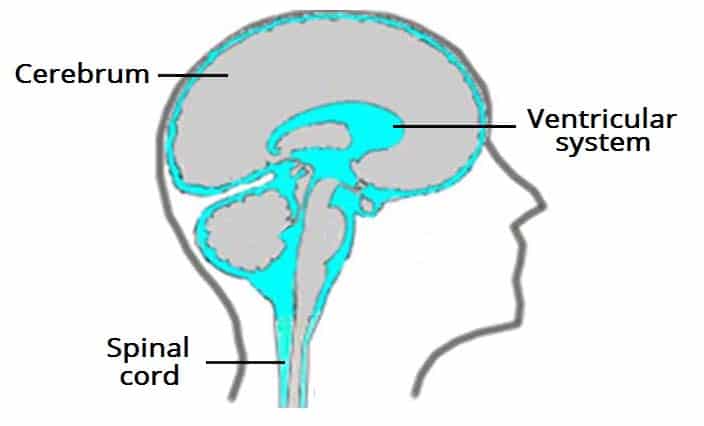 blood in spinal fluid in brain