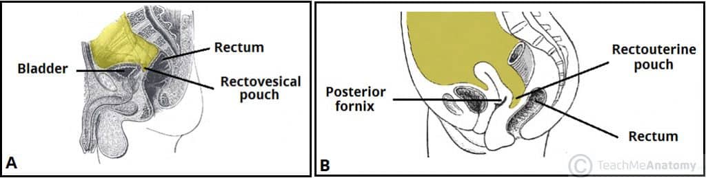 Fig 2 - The peritoneal reflections of the rectum in males (A) and females (B).