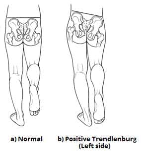 superior gluteal nerve