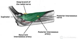 Illustration showing the deep branch of the radial nerve piercing the supinator muscle, identified as the posterior interosseous nerve.