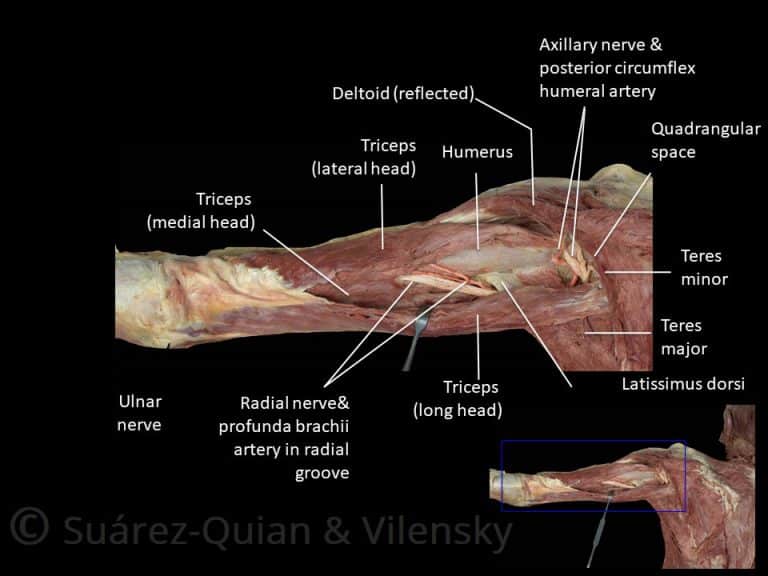 The Radial Nerve - Course - Motor - Sensory - TeachMeAnatomy