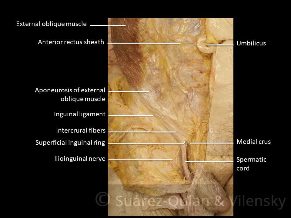 3D Tour of the Inguinal Canal 