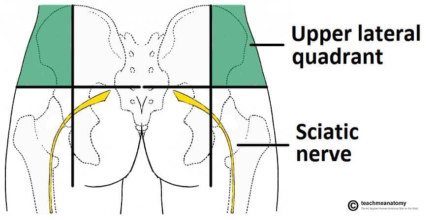 Fig 1.1 - Safe intramuscular injections into the gluteal region.