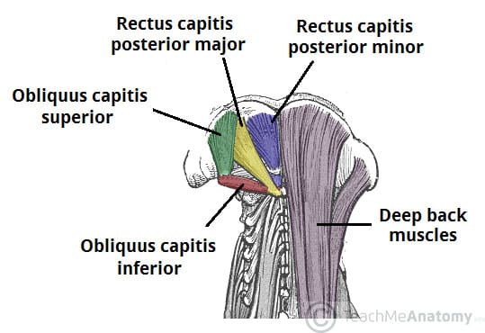 Fig 1 - The left occipital muscles, which lie underneath the deep muscles of the back.