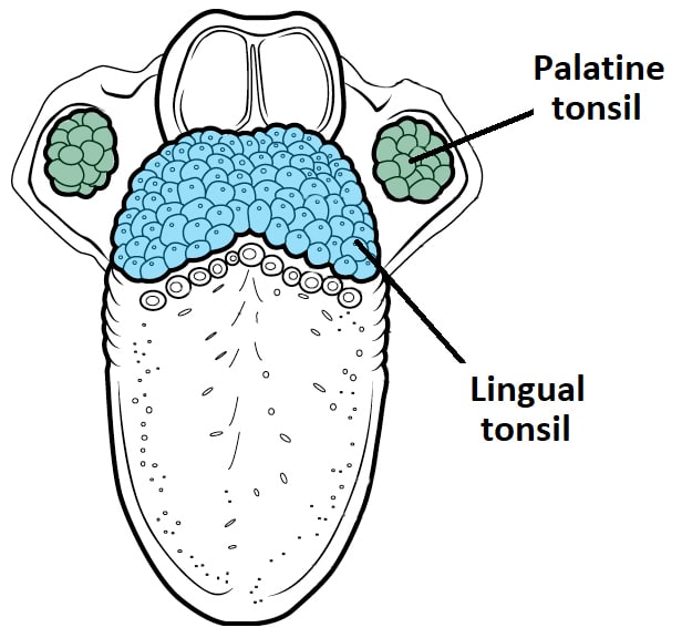 The Lingual Tonsil Waldeyers Ring