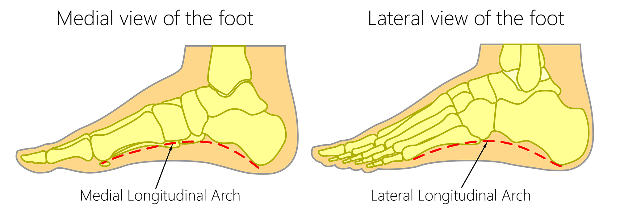 low arch vs high arch feet