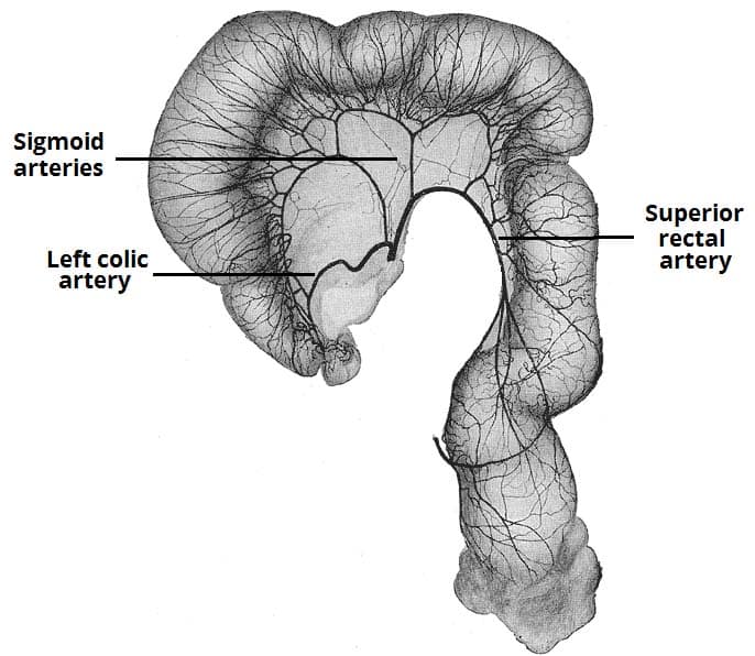 Fig 1.1 - The major branches of the IMA supplying the sigmoid and colon. 