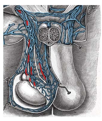 Fig 1.2 - The pampiniform plexus. Note how it surrounds the testicular artery.