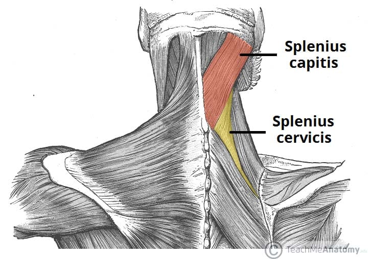 Fig 1.0 - The splenius muscles, located with the superficial layer of intrinsic back muscles.